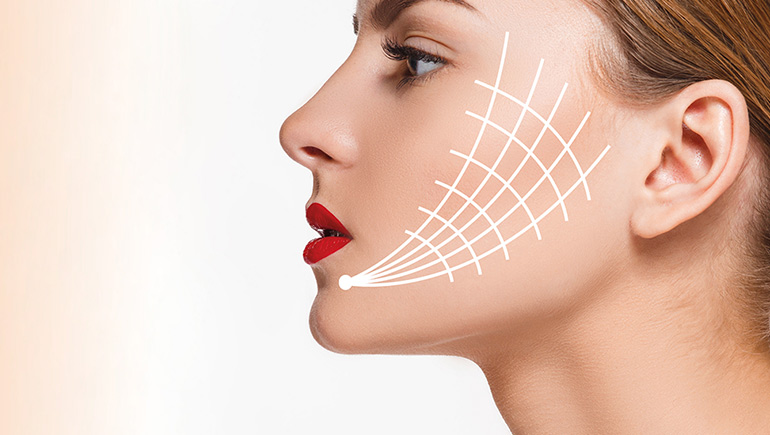  Age-Defying Elegance: The Art of Thread Lift Facial Treatment
